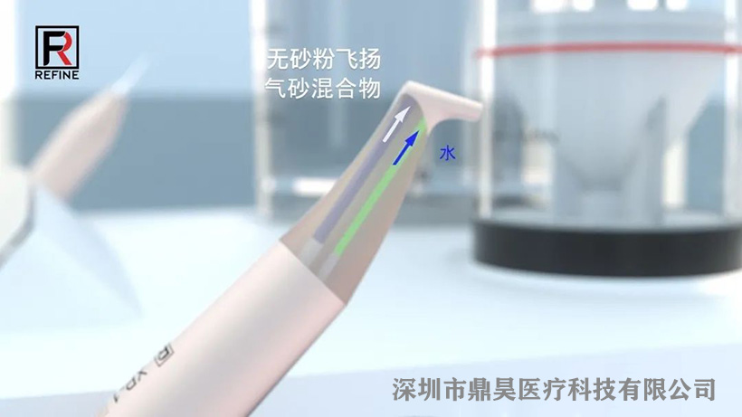 喷砂超声牙周治疗仪PTX-高性能防堵系统